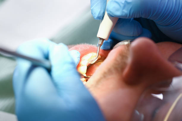 Best Walk-In Emergency Dentist in Dunlap, IL